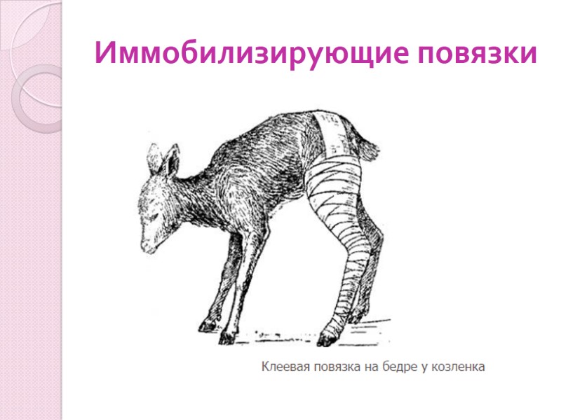 Иммобилизирующие повязки